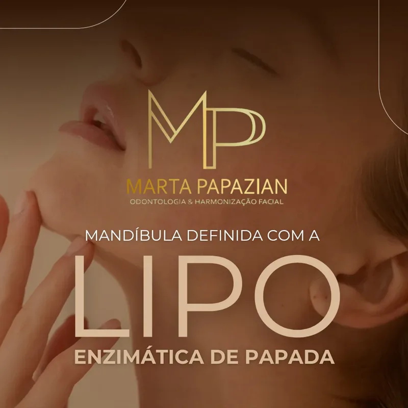 Lipo enzimática de papada